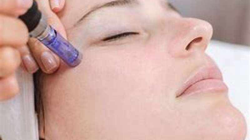 What Is Micro Needling?